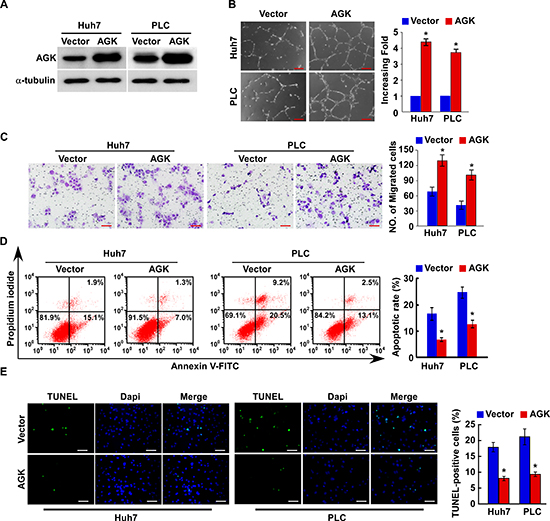Overexpression of AGK promotes angiogenesis and inhibits apoptosis in HCC cells in vitro.