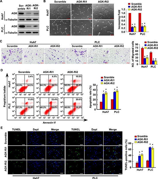 Silencing of AGK inhibits angiogenesis and induces apoptosis in HCC cells in vitro.