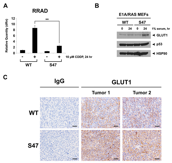 Decreased induction of RRAD and increased expression of GLUT1 in cells and tumors containing the S47 variant.