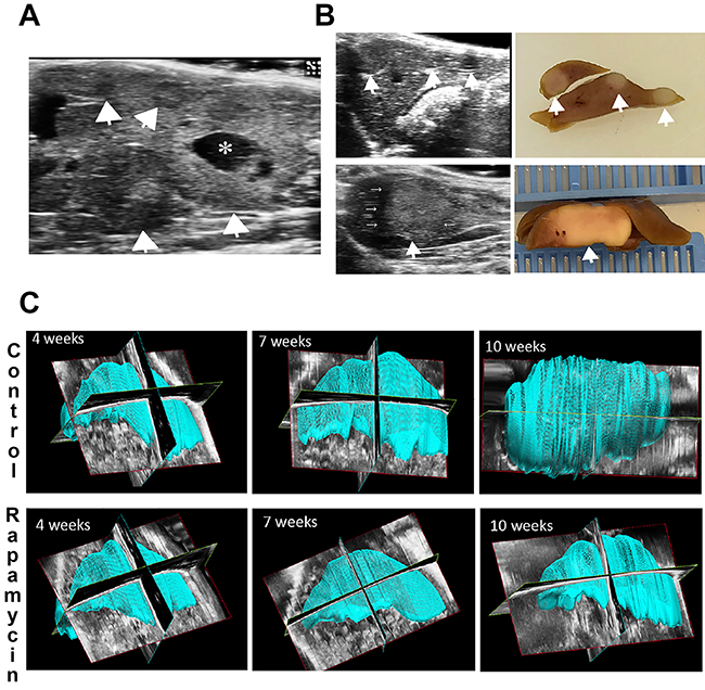 Ultrasound and ultrasound-based 3D to detect HB and liver volume in the Yap1-&#x03B2;-catenin model.