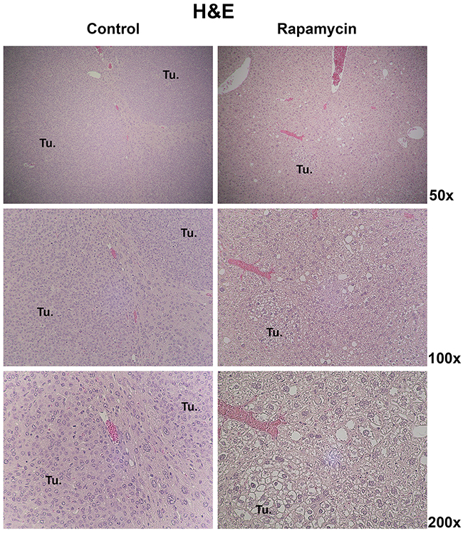 Histology of HB in the Yap1-&#x03B2;-catenin with and without Rapamycin treatment.