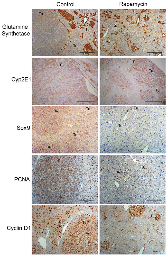 Molecular characterization of HB in the Yap1-&#x03B2;-catenin HB mice treated with Rapamycin as compared to the untreated group.