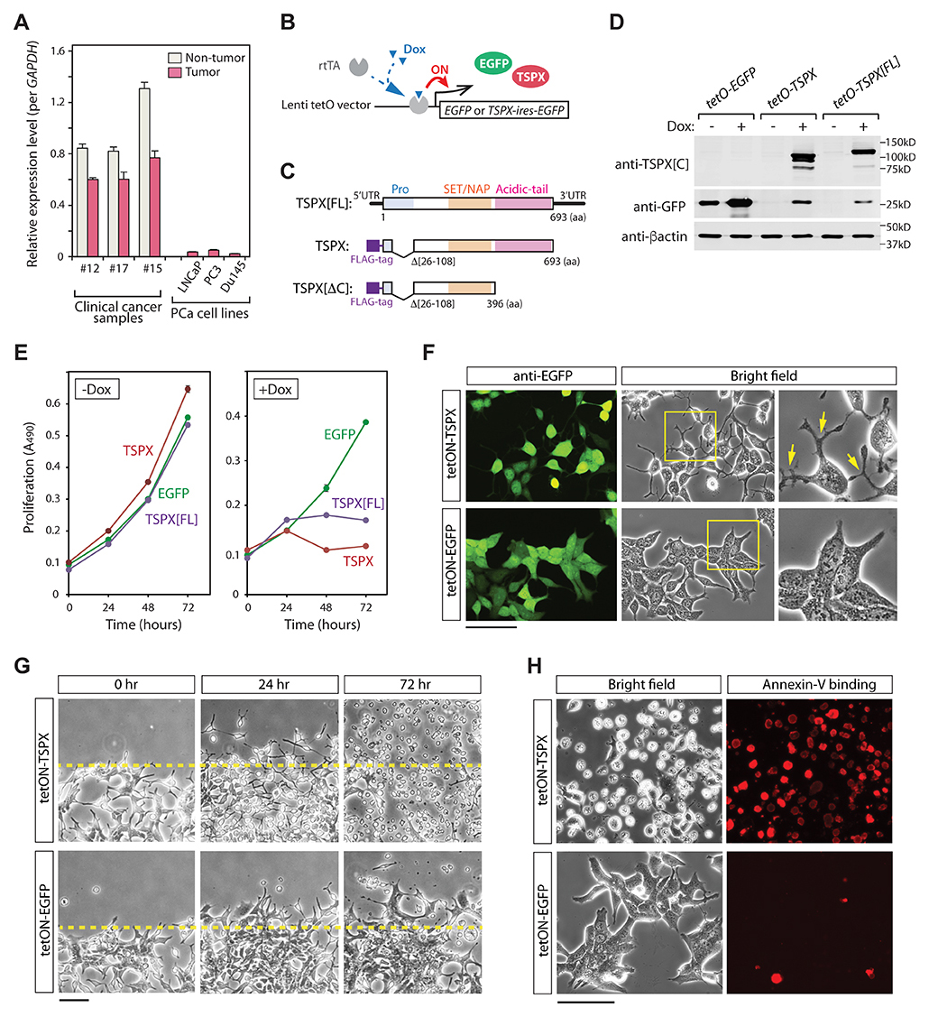 Overexpression of TSPX caused morphological changes and cell-death in LNCaP cells.