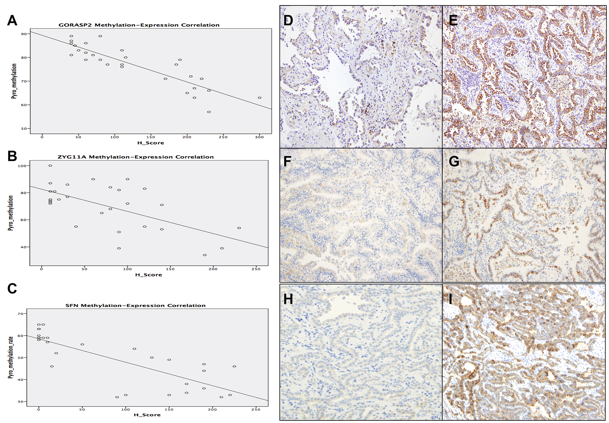 GORASP2, ZYG11A, and SFN methylation-expression correlation and IHC staining pattern.