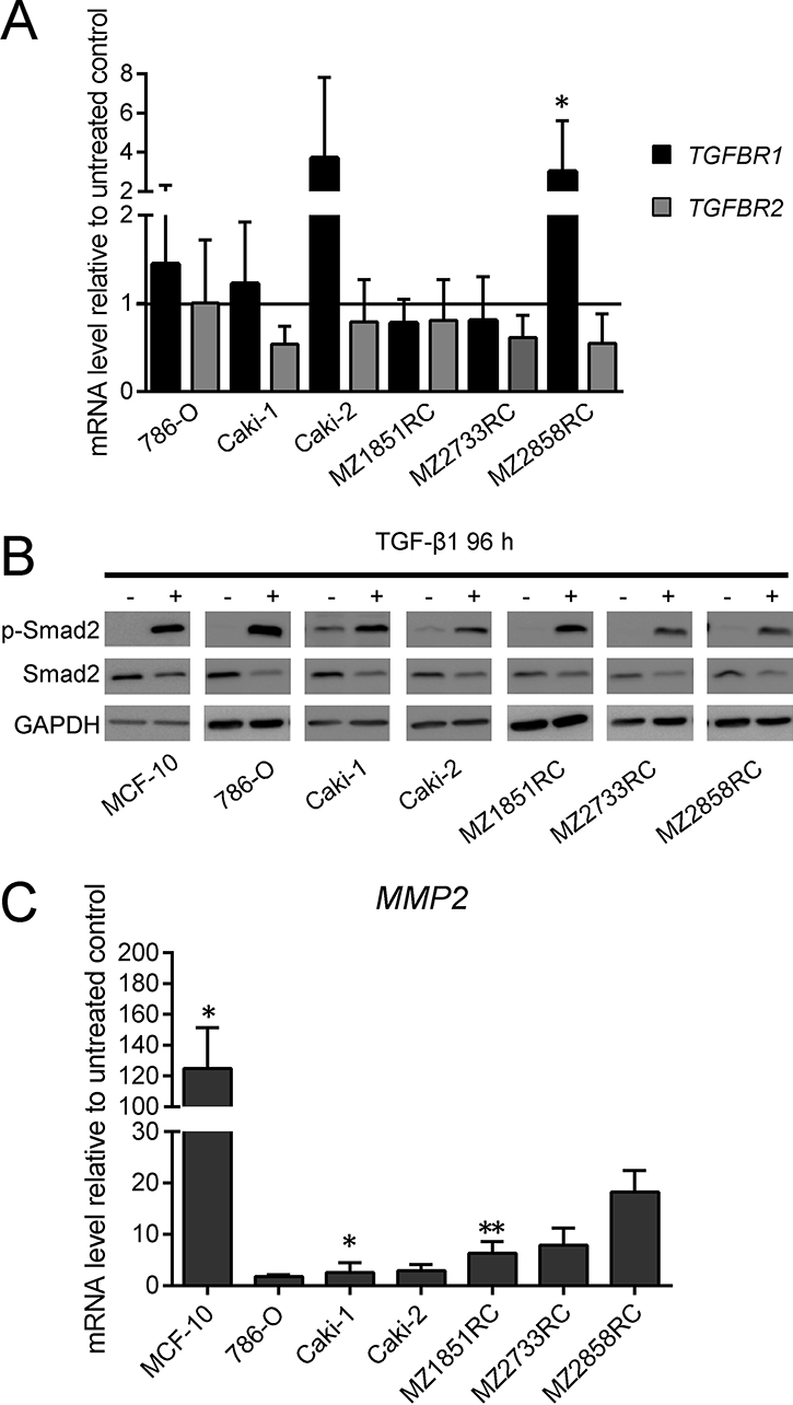 Effect of TGF-&#x03B2;1 treatment on key players of the TGF-&#x03B2;/Smad-signaling pathway.