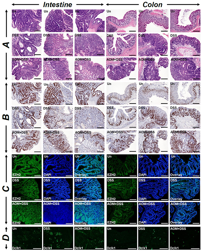 Measuring the combined effect of DSS and AOM+DSS on tumorigenesis.