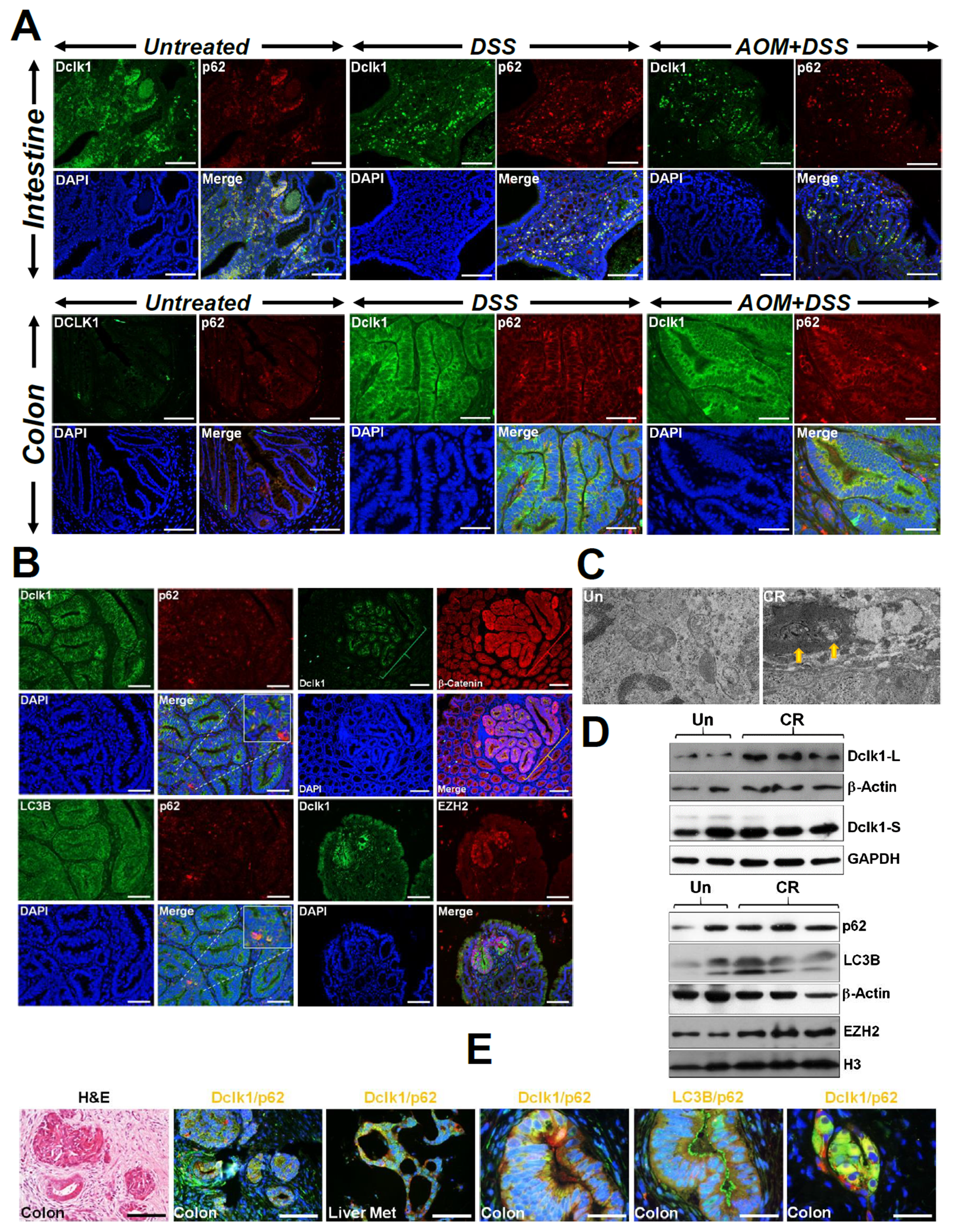 Epithelial injury promotes accumulation of p62.