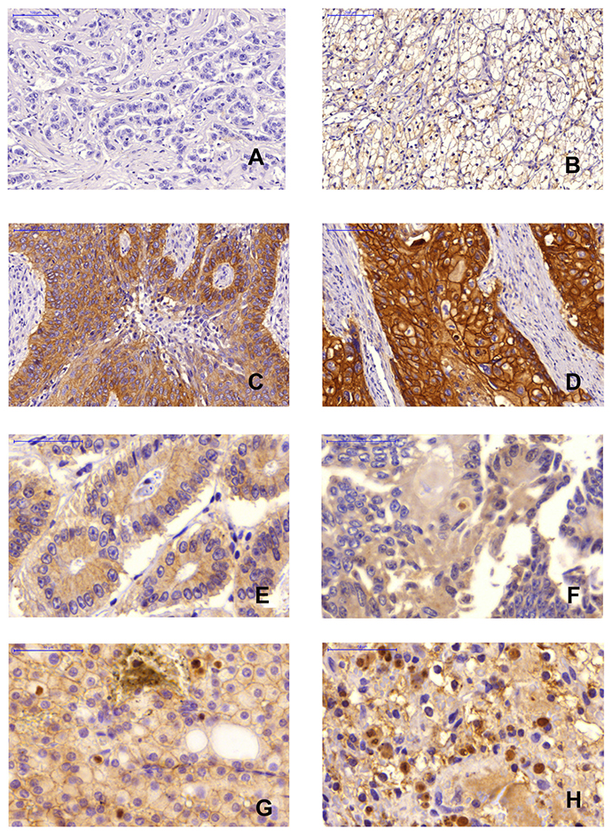 Immunohistochemical staining.