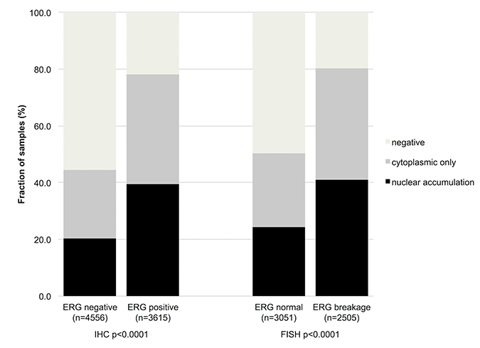 Association between increasing GSK3&#x00DF; staining and ERG status determined by IHC and FISH.