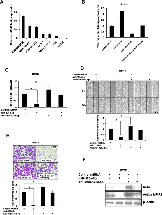 Expression and function of miR-125a-5p in breast cancer.