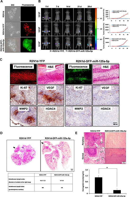 Tumor suppression functions of miR-125a-5p in vivo.