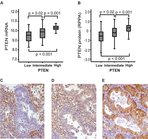 Immunohistochemical staining of PTEN associates with mRNA and protein RPPA-expression.