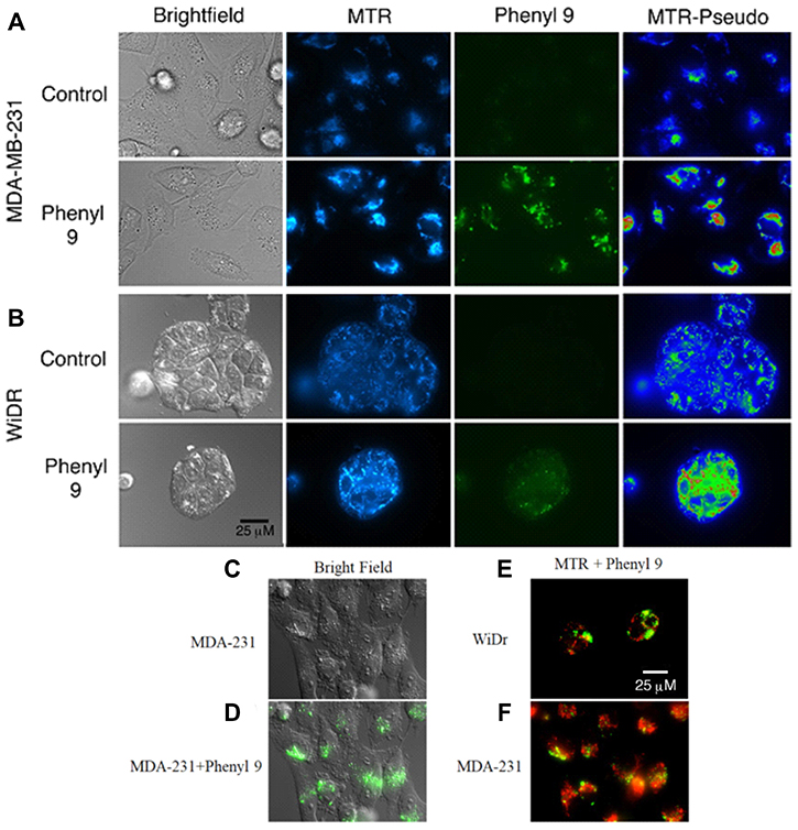 Mitotracker red staining in compound 9 treated MDA-MB-231 and WiDr cell lines.