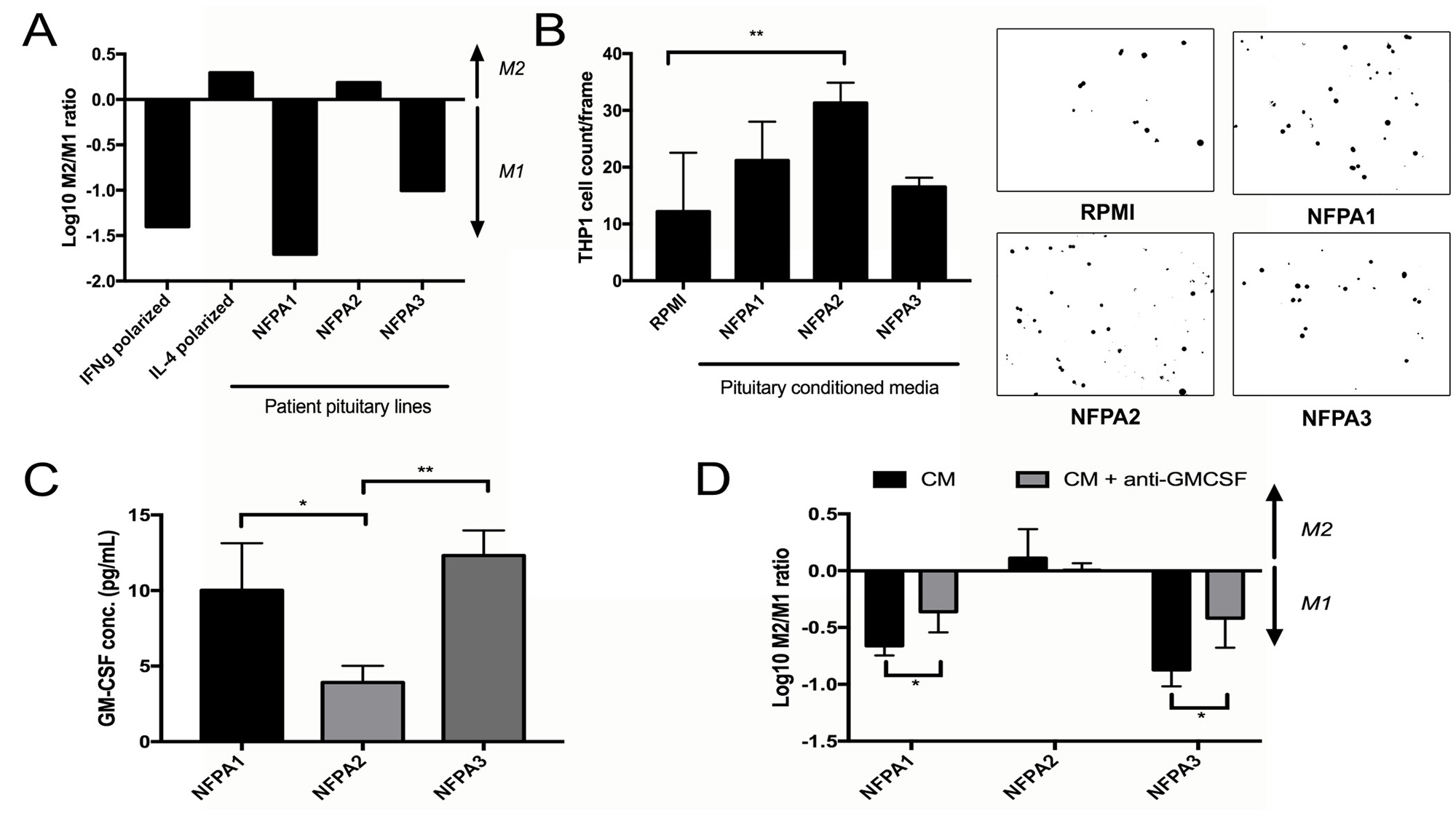 Impact of NFPA cells on TAMs.