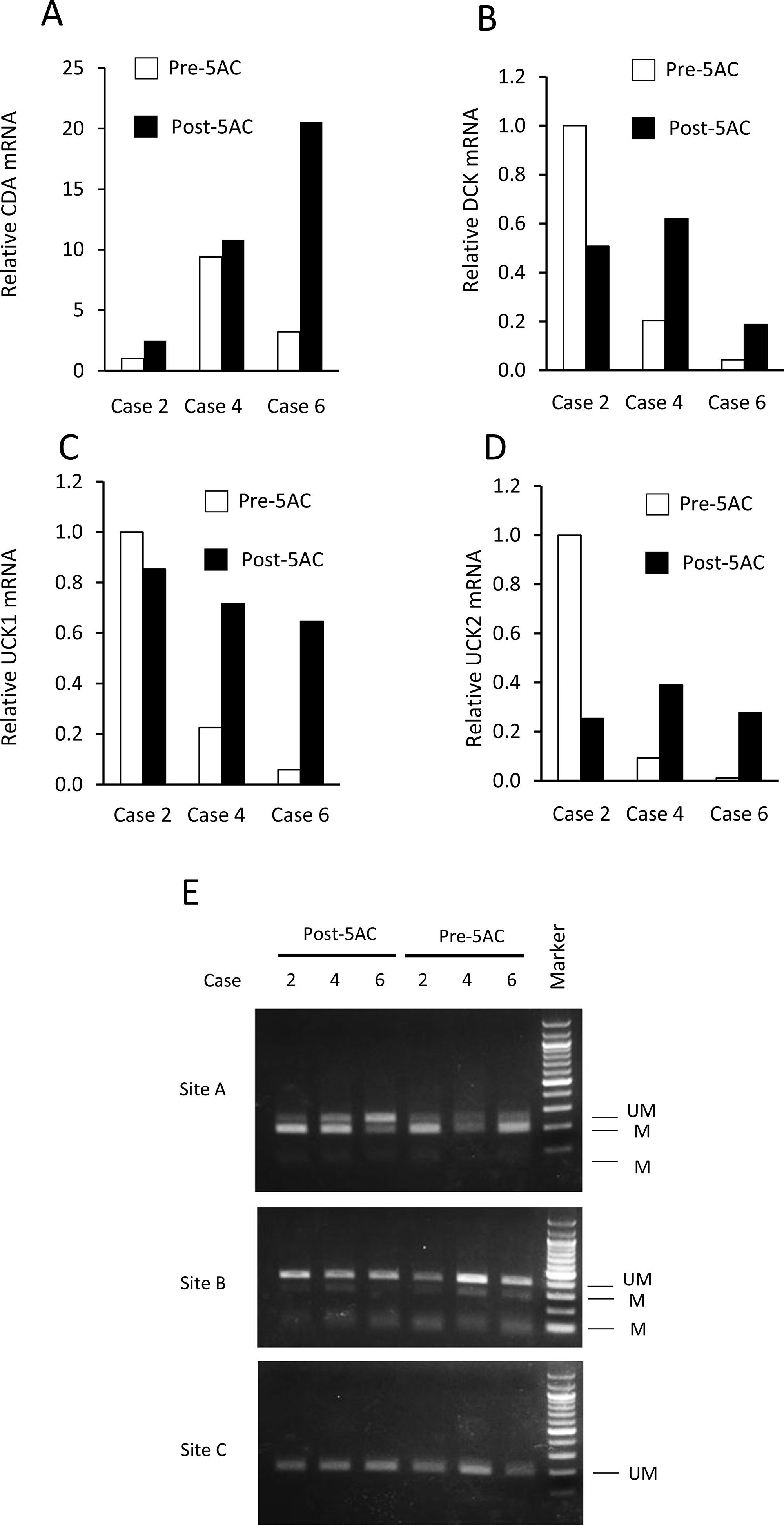 The expression levels of CDA, DCK, UCK1 and UCK2 mRNA and the methylation status at the 5′-flanking regions of the CDA gene before and after 5AC treatment in three matched clinical samples.