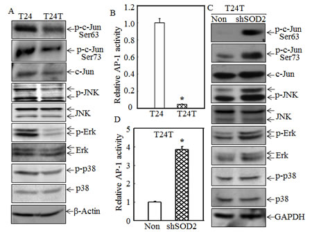 SOD2 inhibited JNK-c-Jun/AP-1 activation in T24T cells.