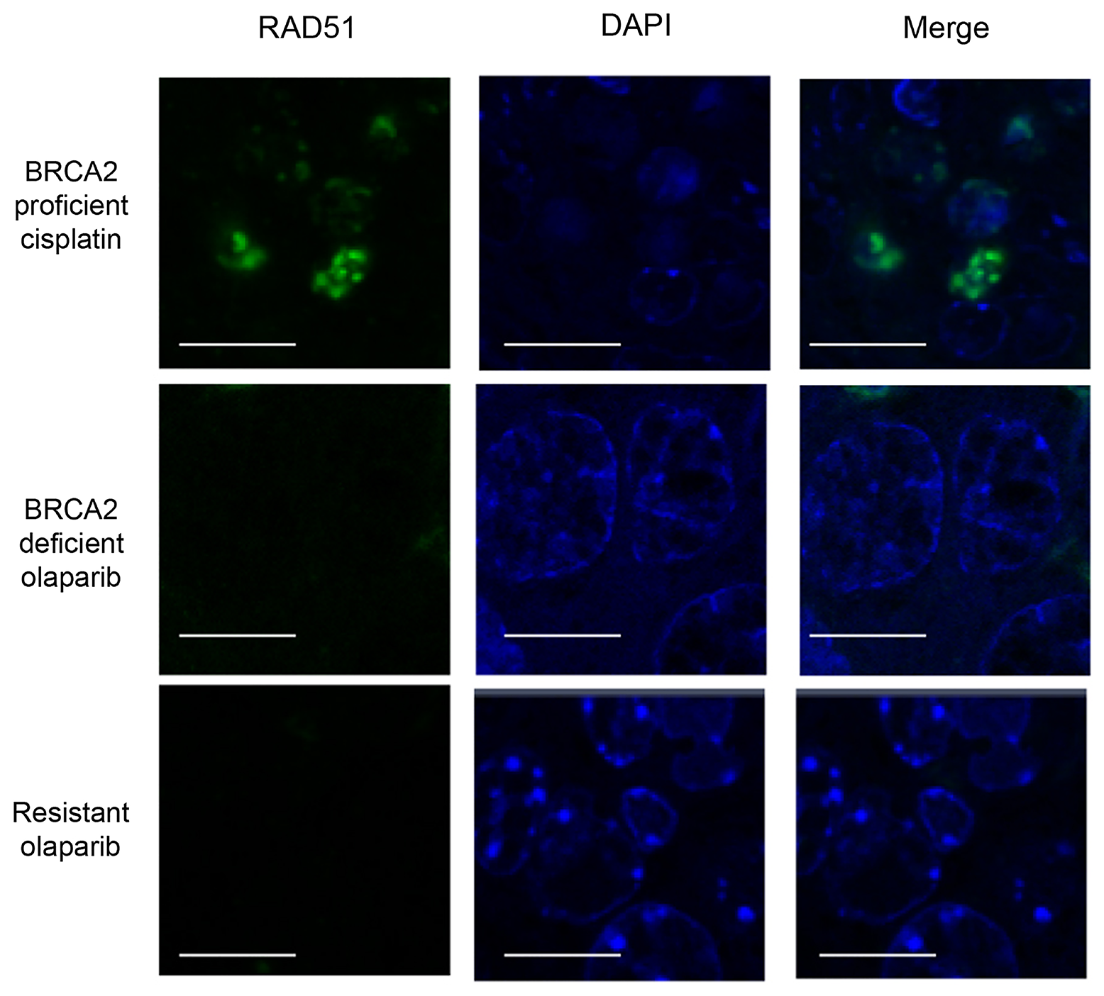 Olaparib-resistant tumours do not have Rad51 foci.