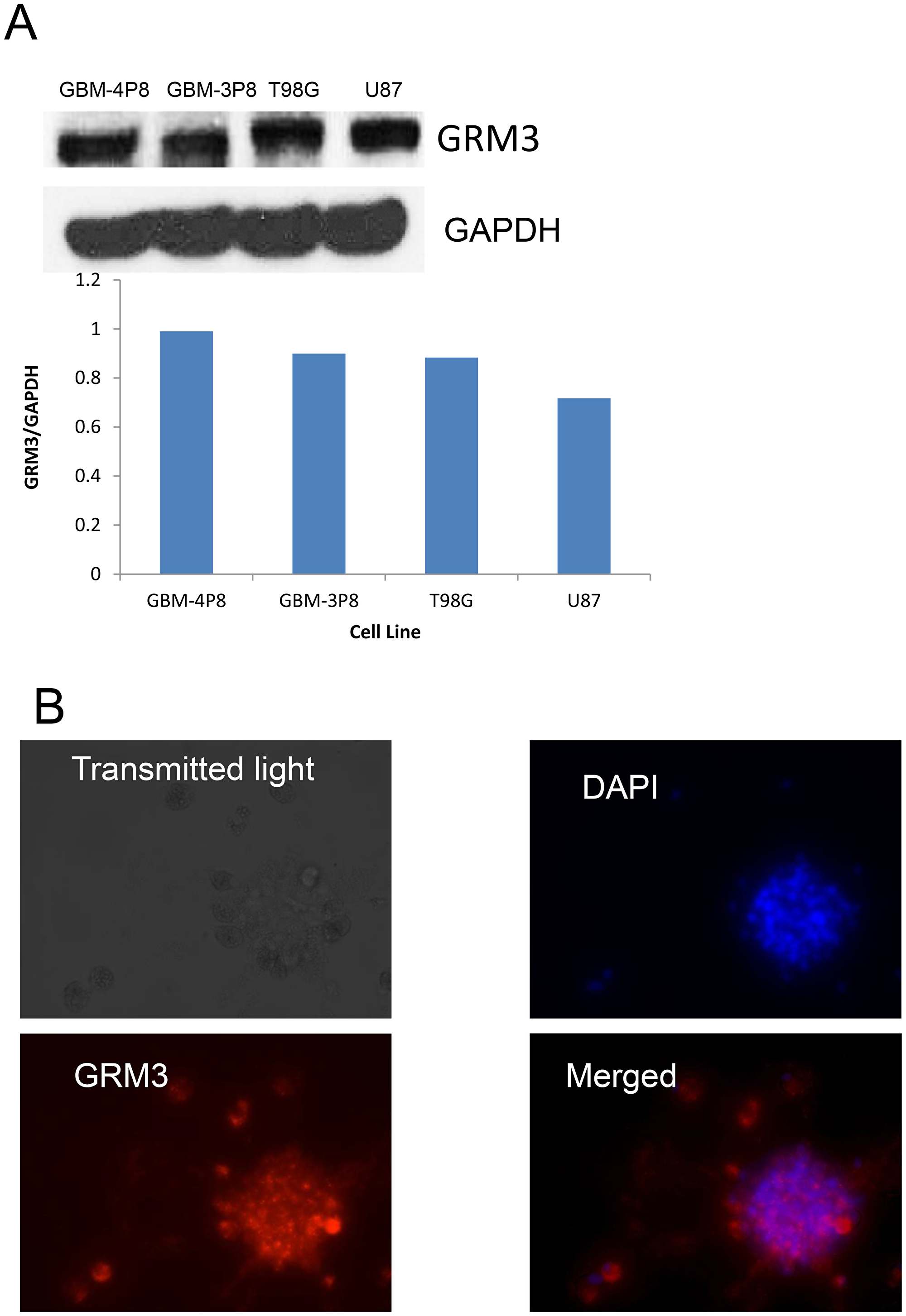 GRM3 is expressed in human gliomas.