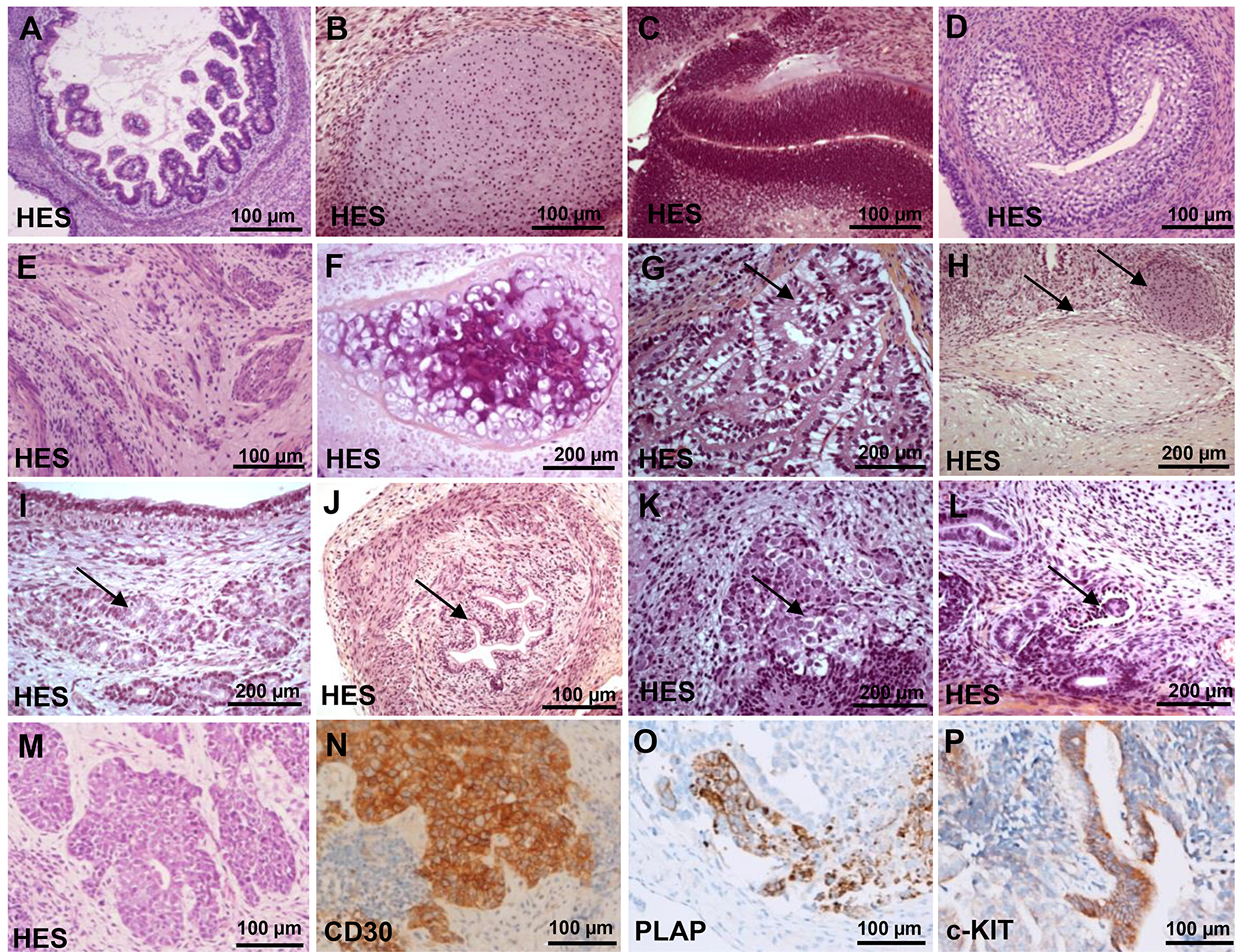 Histological analysis of teratomas by haematoxylin and eosin staining (HES).