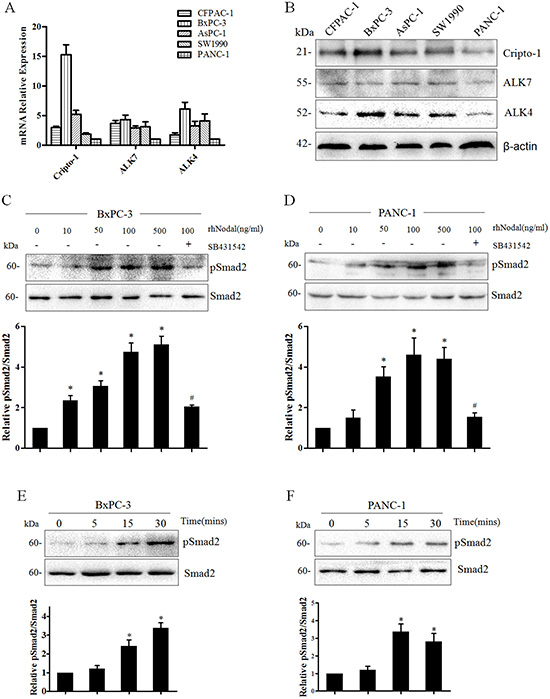 Nodal signaling in human pancreatic cancer cell lines.