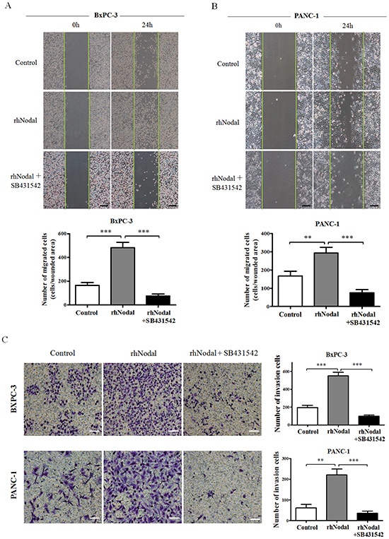 Nodal enhances pancreatic cancer cell migration and invasion.