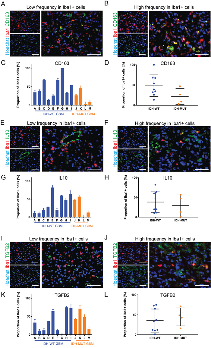 Anti-inflammatory markers are differentially expressed by GAMMs.
