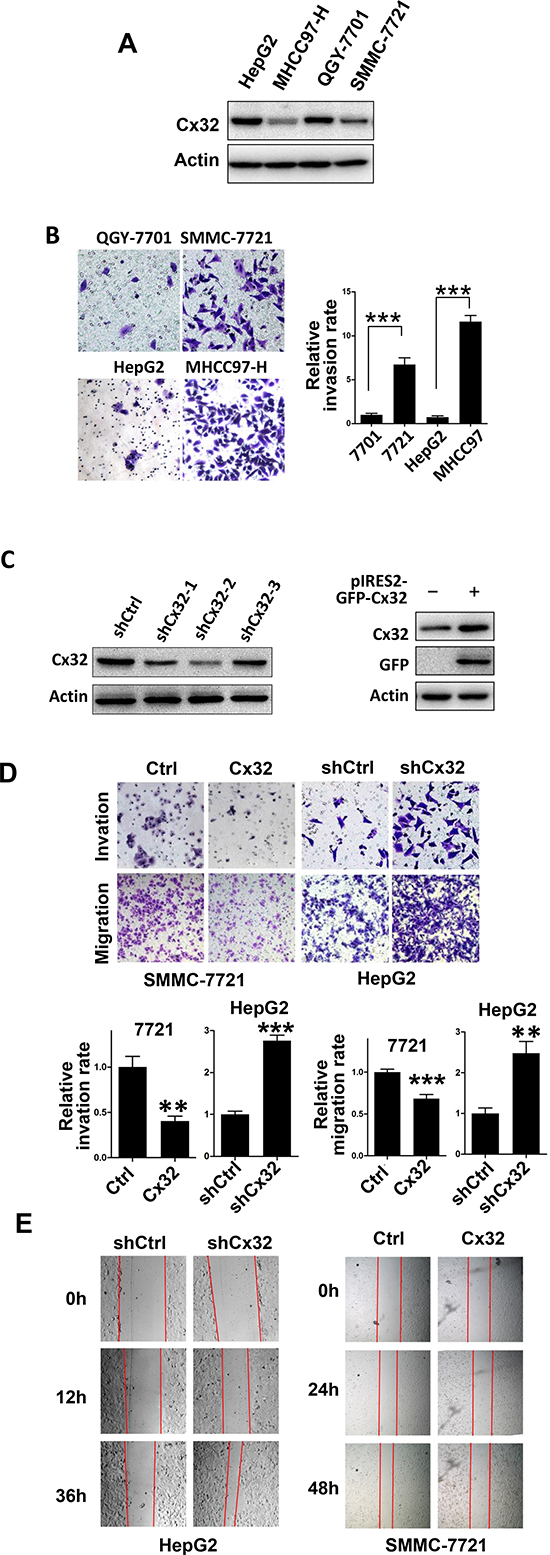 Cx32 represses HCC cell invasion and migration.