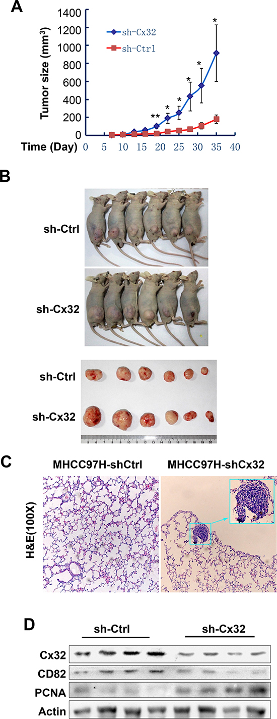 Cx32 suppresses HCC growth and pulmonary metastasis in mouse models.