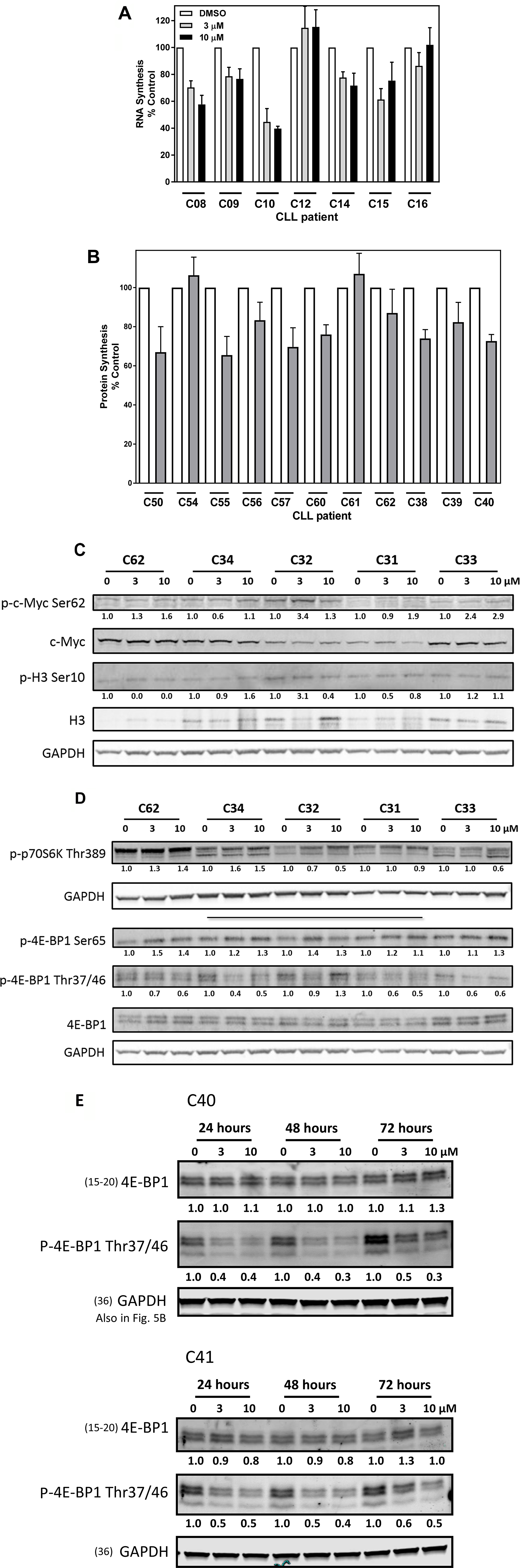 Effects of AZD1208 treatment on RNA and protein synthesis and PIM kinase substrates in chronic lymphocytic leukemia (CLL) lymphocytes.