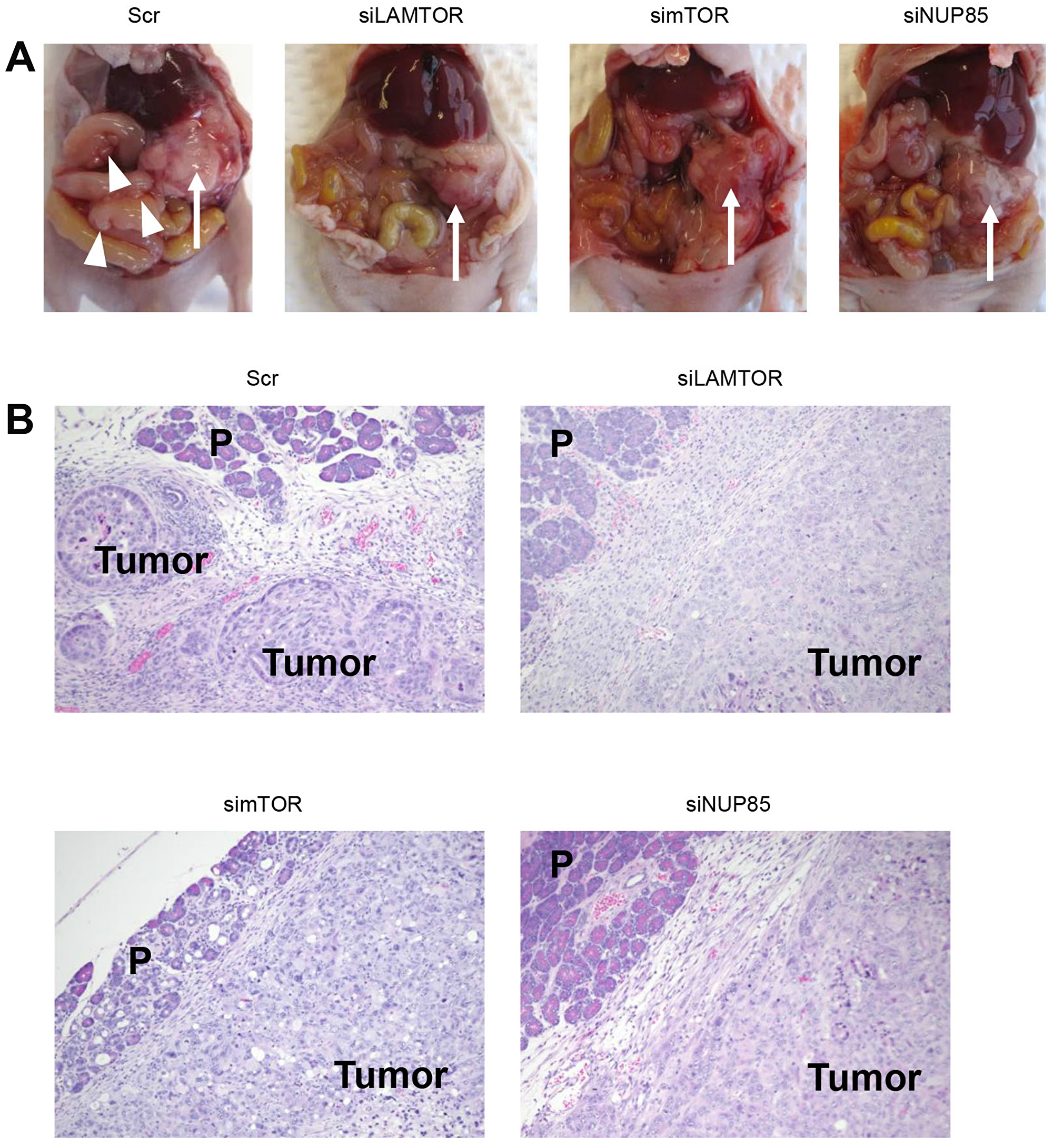 Disease progression in the orthotopic mouse model of PDAC.