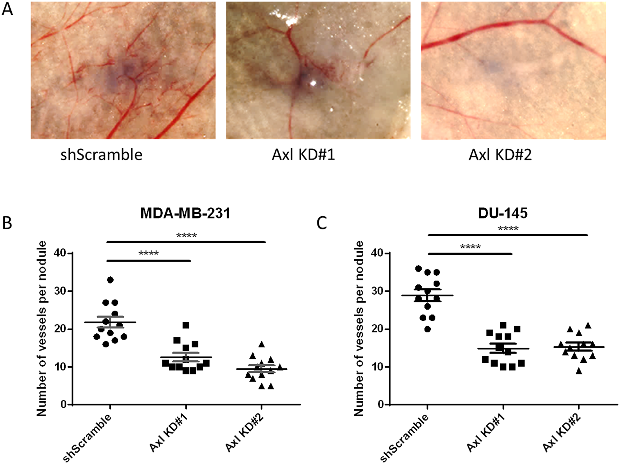 Axl knockdown of tumor cells suppresses tumor cell-induced angiogenesis in vivo.