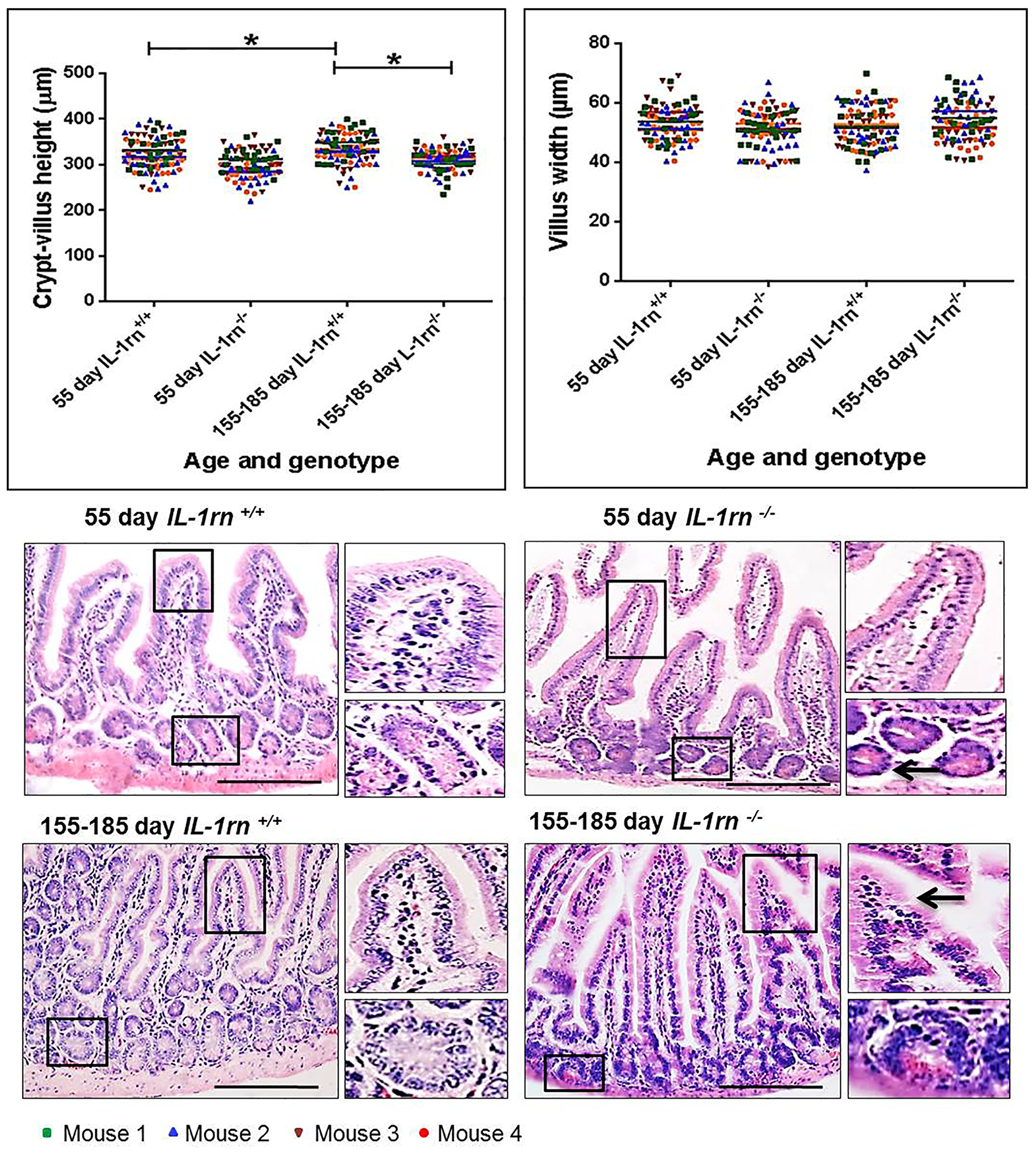 Histological analysis and morphology of the intact well-oriented crypt-villus axis heights and villus widths of Jejunum in the 55 day old IL-1rn-/- mice and 155-185 day old IL-1rn-/- mice compared to age-matched wild-type mice.
