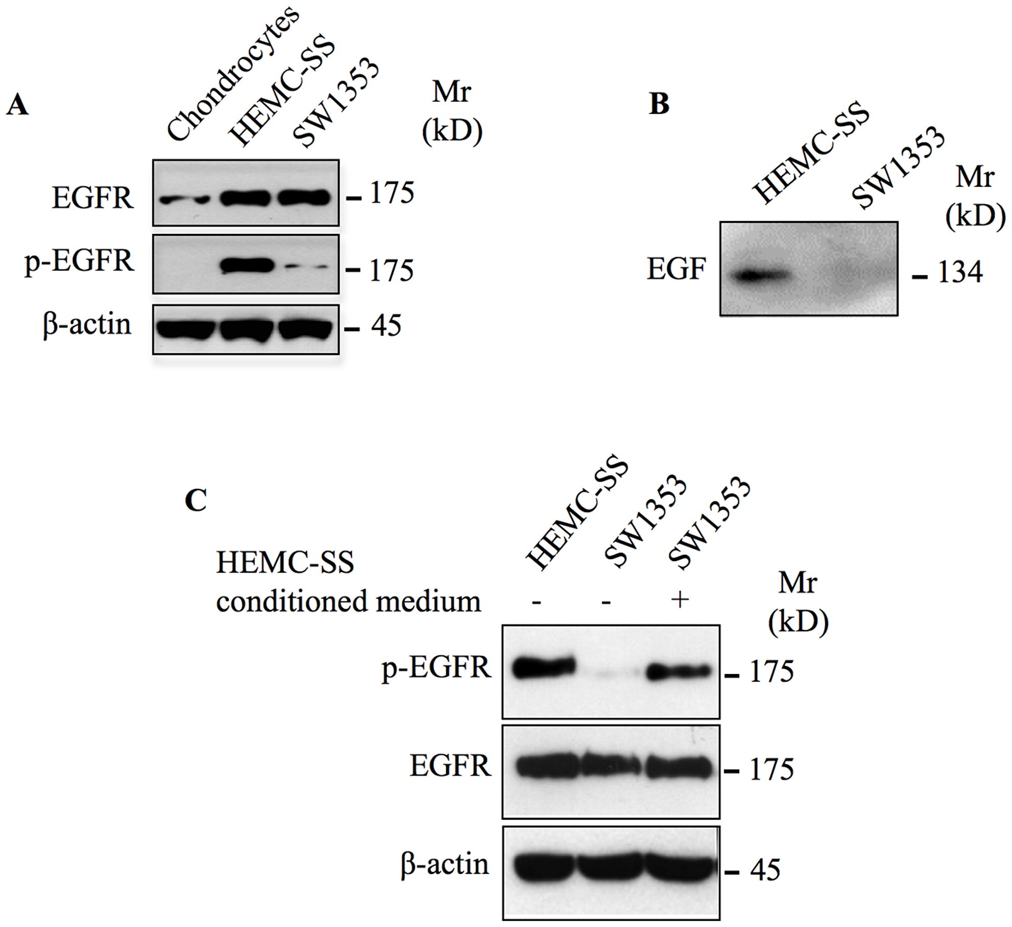 EGFR is overexpressed and constitutively activated in chondrosarcoma cells.