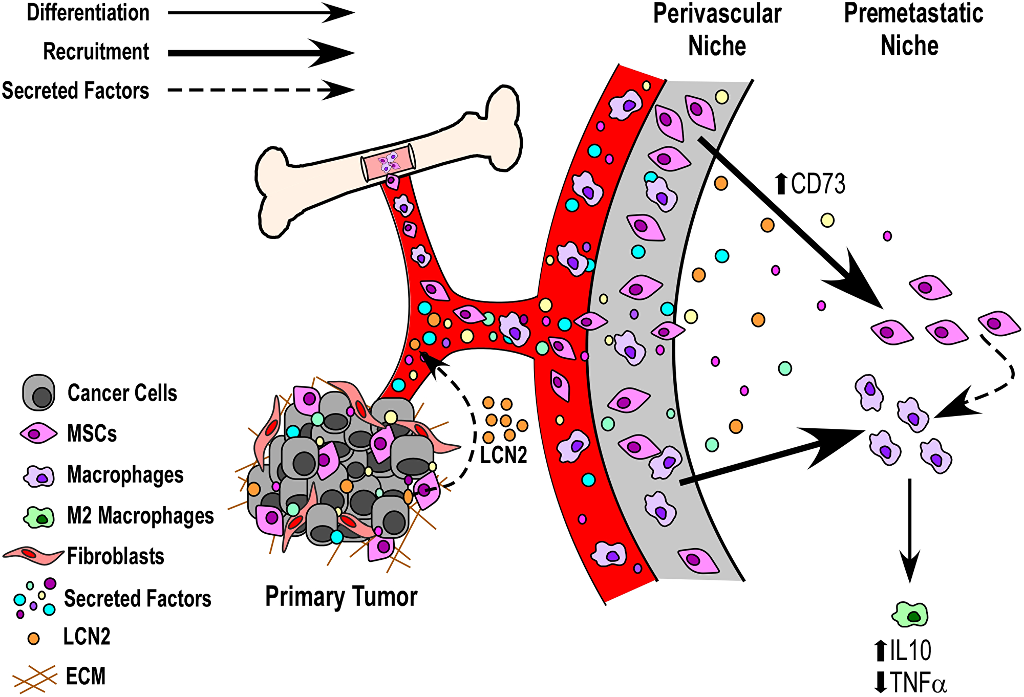 Model of potential mechanisms by which soluble factors from the primary breast tumors may induce an anti-inflammatory state within premetastatic tissues.