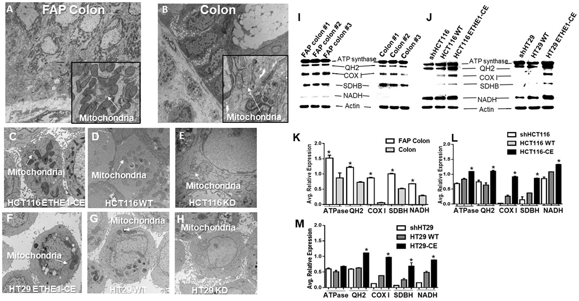 ETHE1 promotes expression of CRC mitochondrial oxidative phosphorylation proteins.