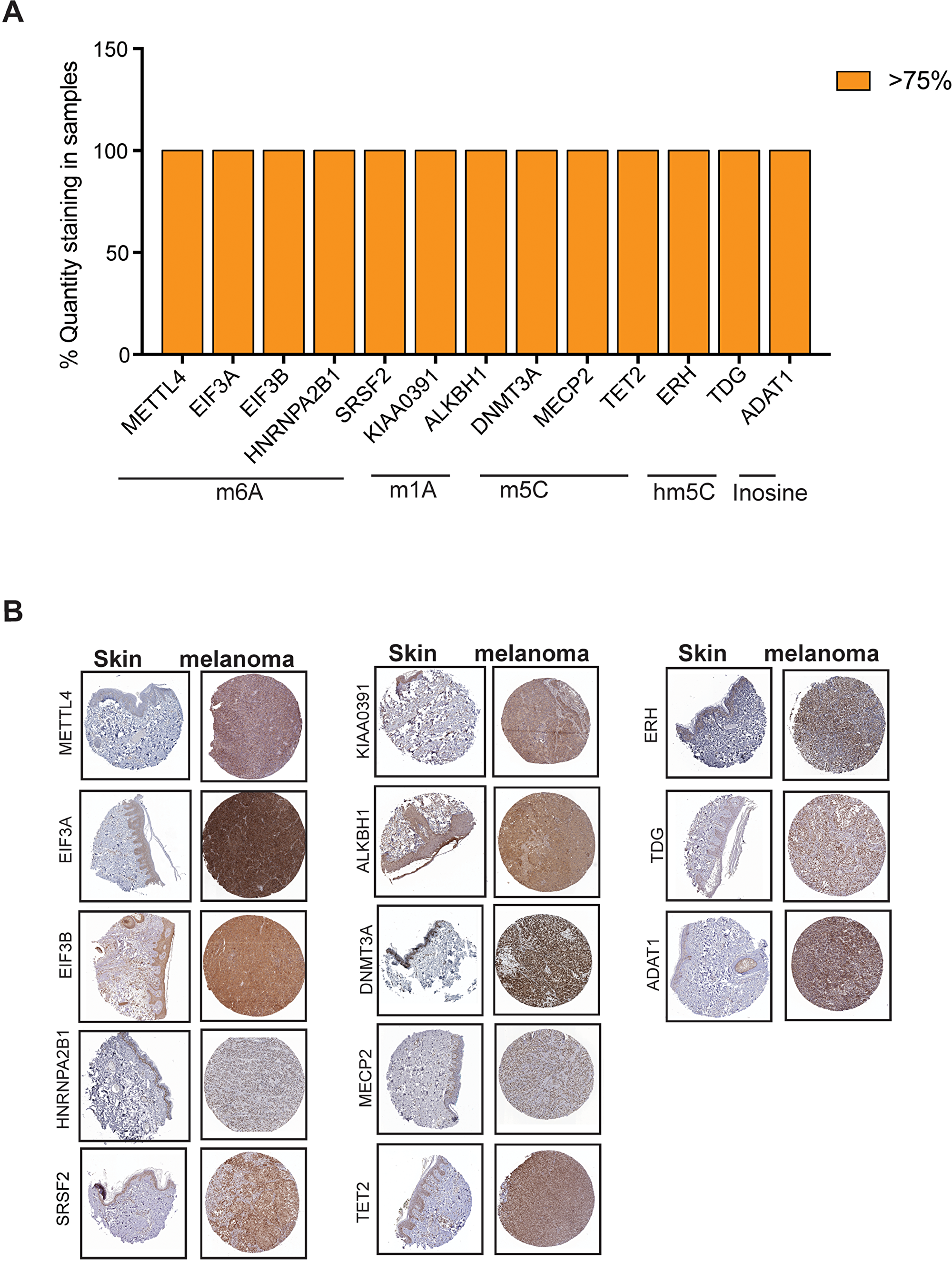 Analysis of expression of RNA modification regulatory proteins in melanoma using The Human Protein Atlas.
