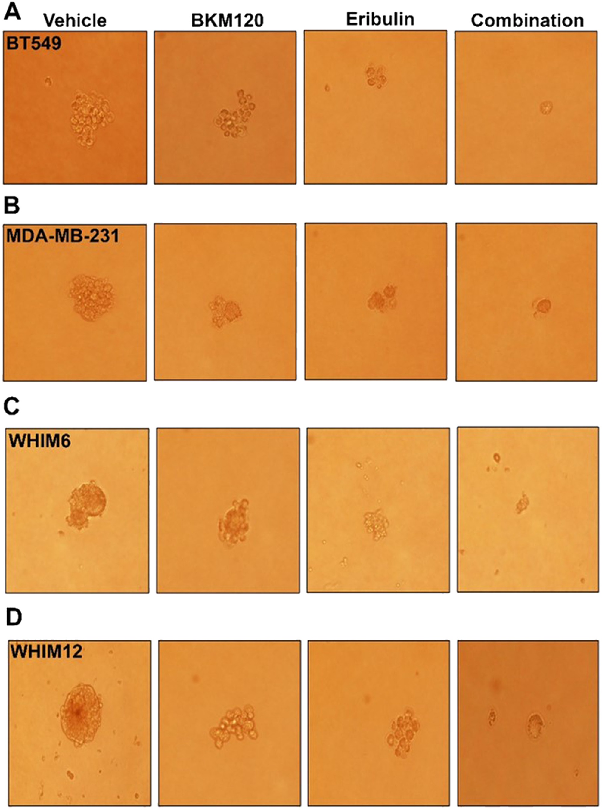 Eribulin alone or in combination with BKM120 inhibited mammosphere formation in TNBC cell lines in vitro.