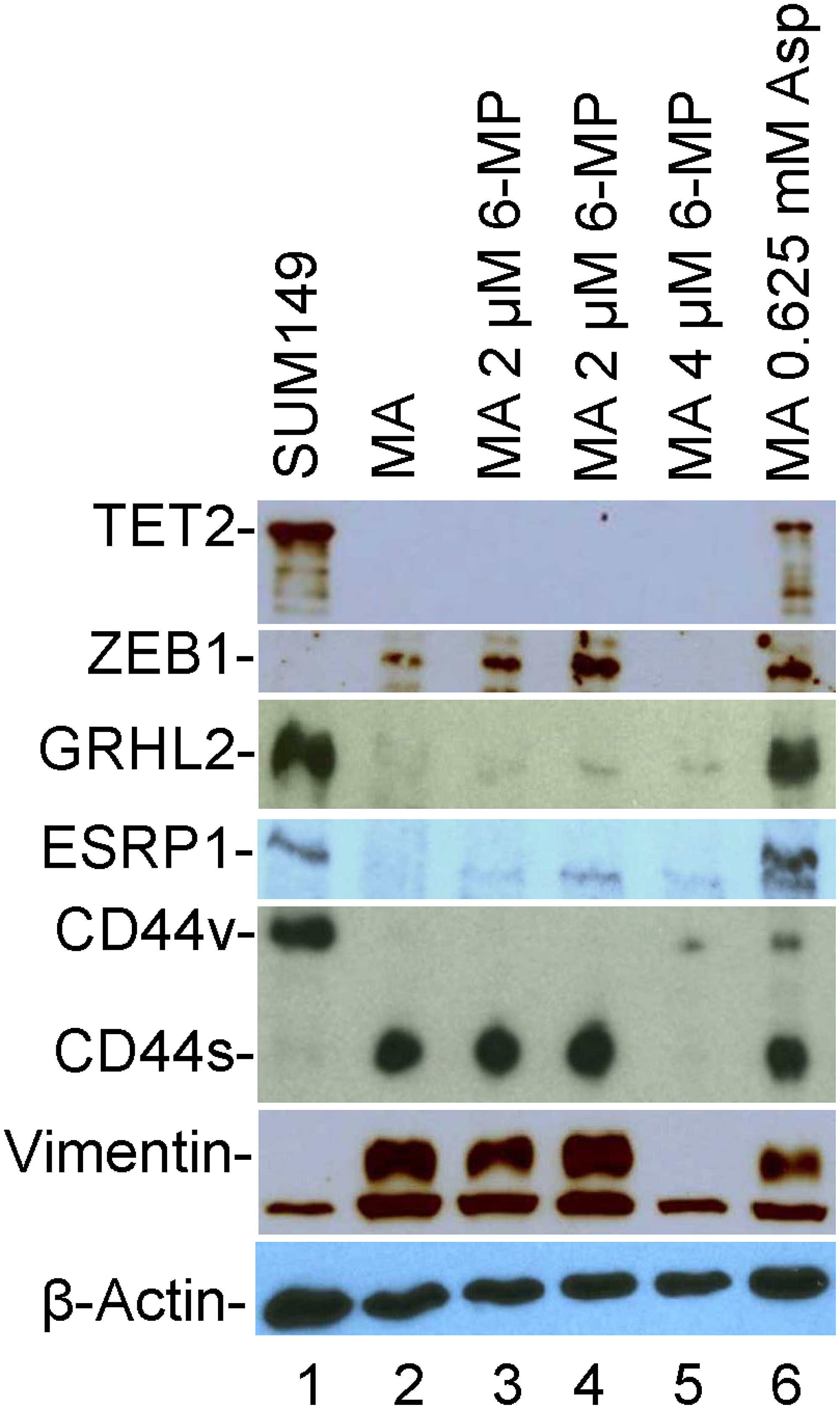 The effects of 6-MP and aspirin on TET2 and EMT-related proteins in SUM149-MA cells.