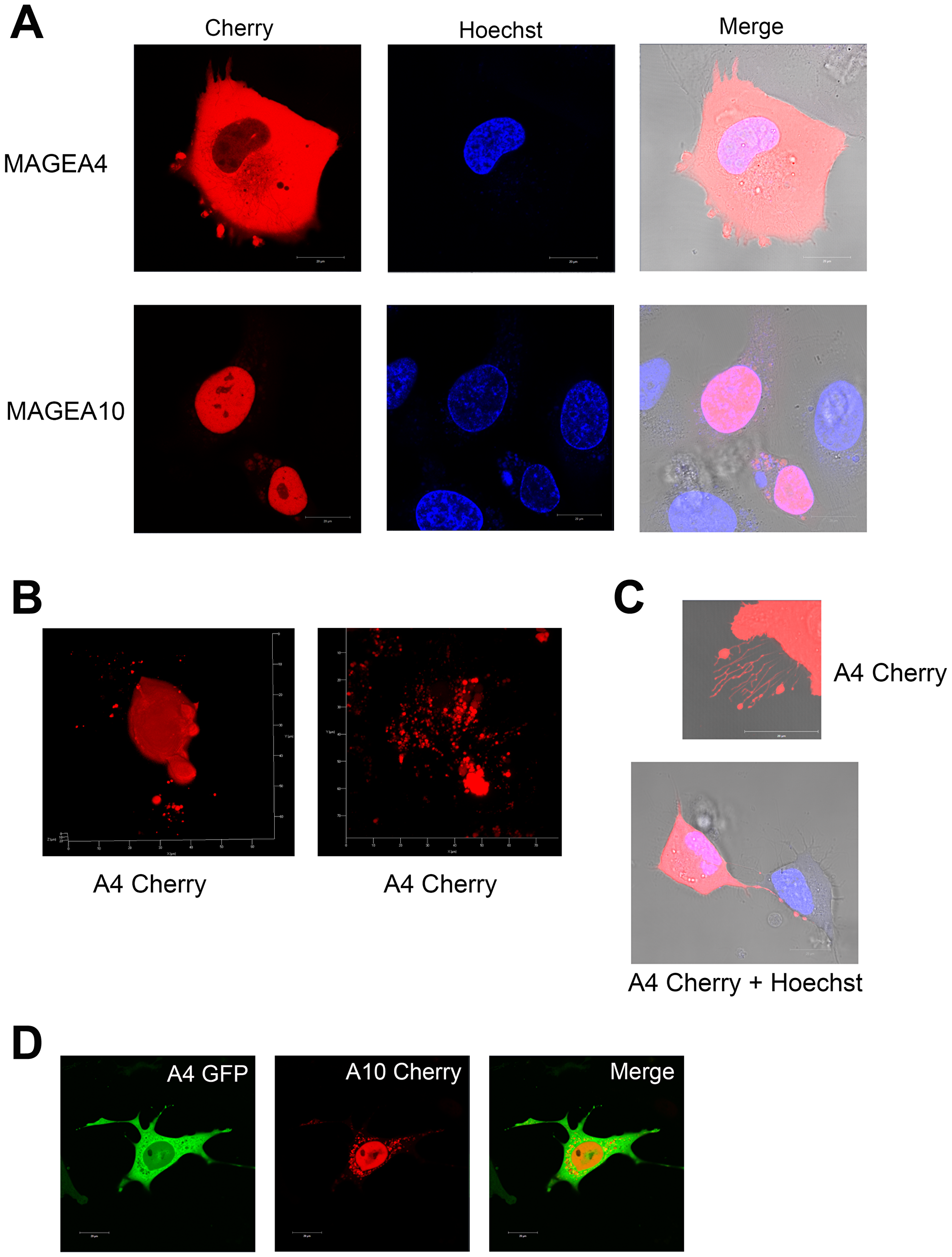 Live-cell imaging of U2OS cells overexpressing MAGEA proteins.