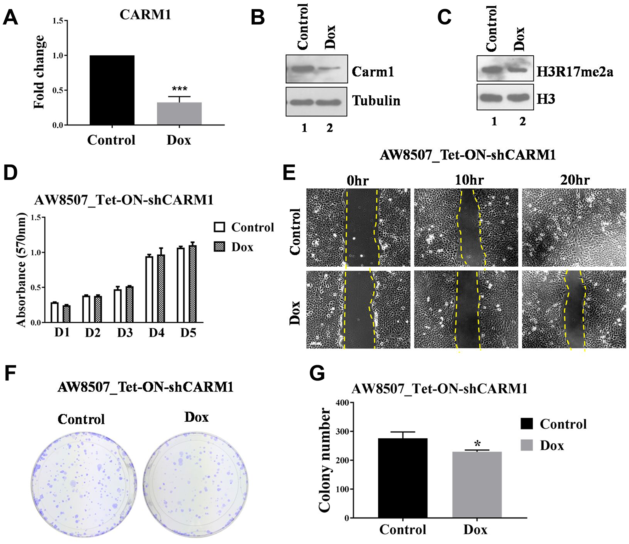 Elucidation of oncogenic role of CARM1 in oral cancer cell line.