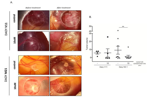 Chick Chorioallantoic Membrane (CAM) tumor growth assay as a model to study PCTK1 inhibition