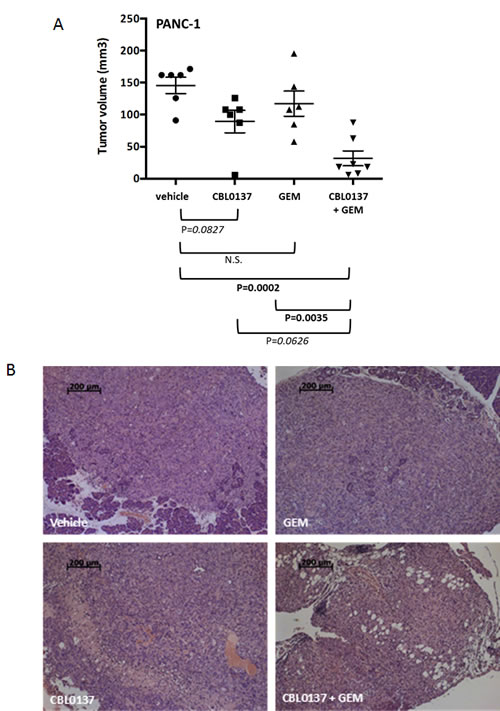Effect of CBL0137 and gemcitabine on orthotopic PANC1 pancreatic tumor growth in nude mice.