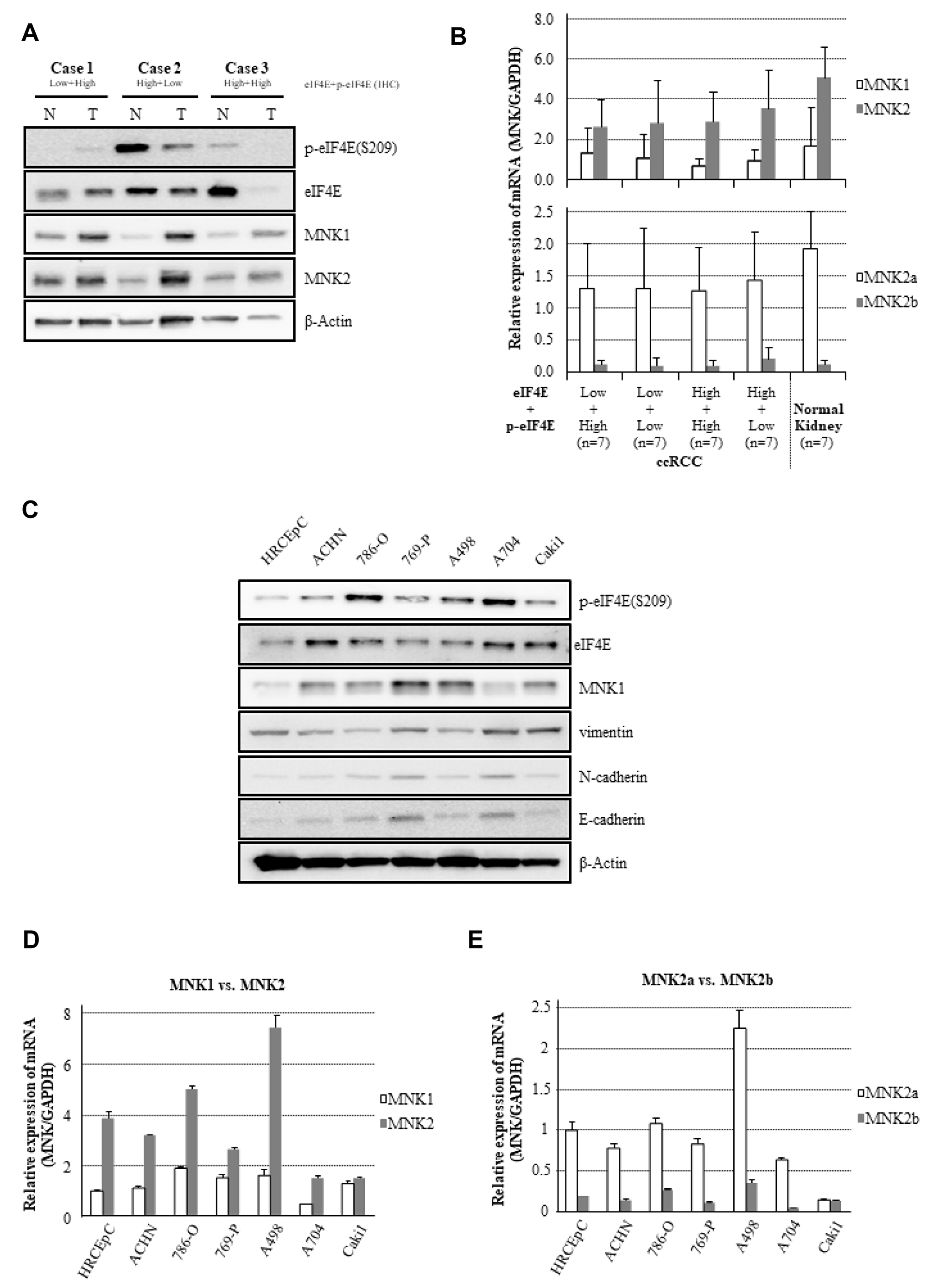 Expressional differences in MNK/eIF4E signaling and molecular markers on EMT.