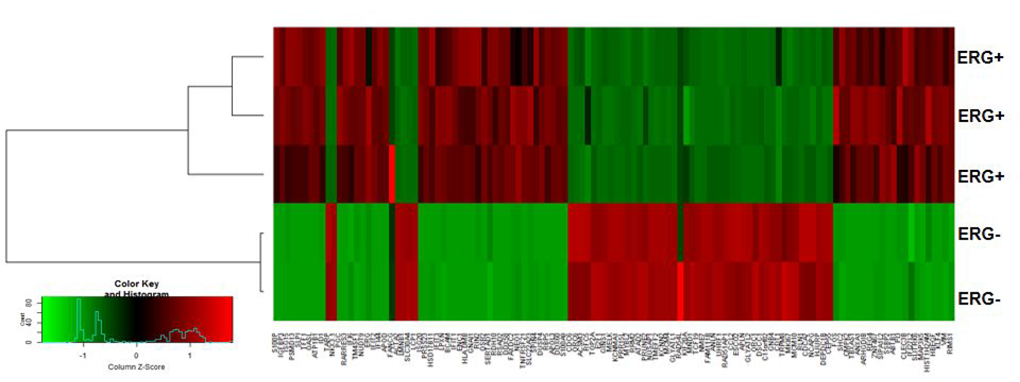 ERG-associated transcripts in CaP cells.