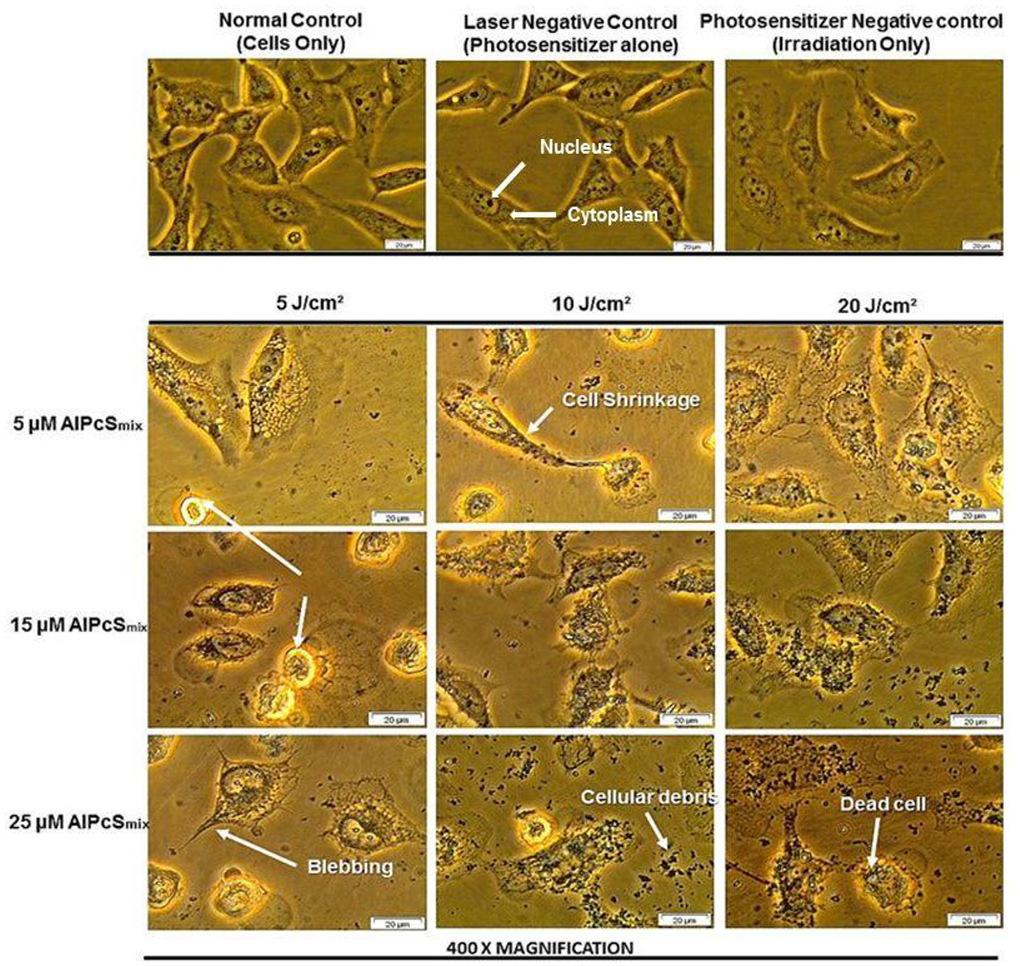Cellular morphology of HeLa total population as seen under 400&times; magnification demonstrating unaltered structure of cells in the control group and groups treated with either of the variables alone and notable distortion in structure in PDT treated cells.
