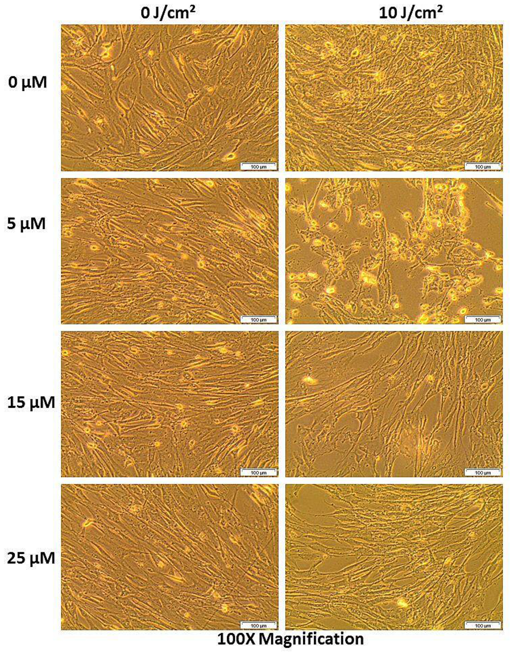 Post-irradiation morphologic assessment of WS1 fibroblasts indicating structural changes in normal cell population after 24 h of incubation (different concentrations aligned in vertical position and the fluences in horizontal position).