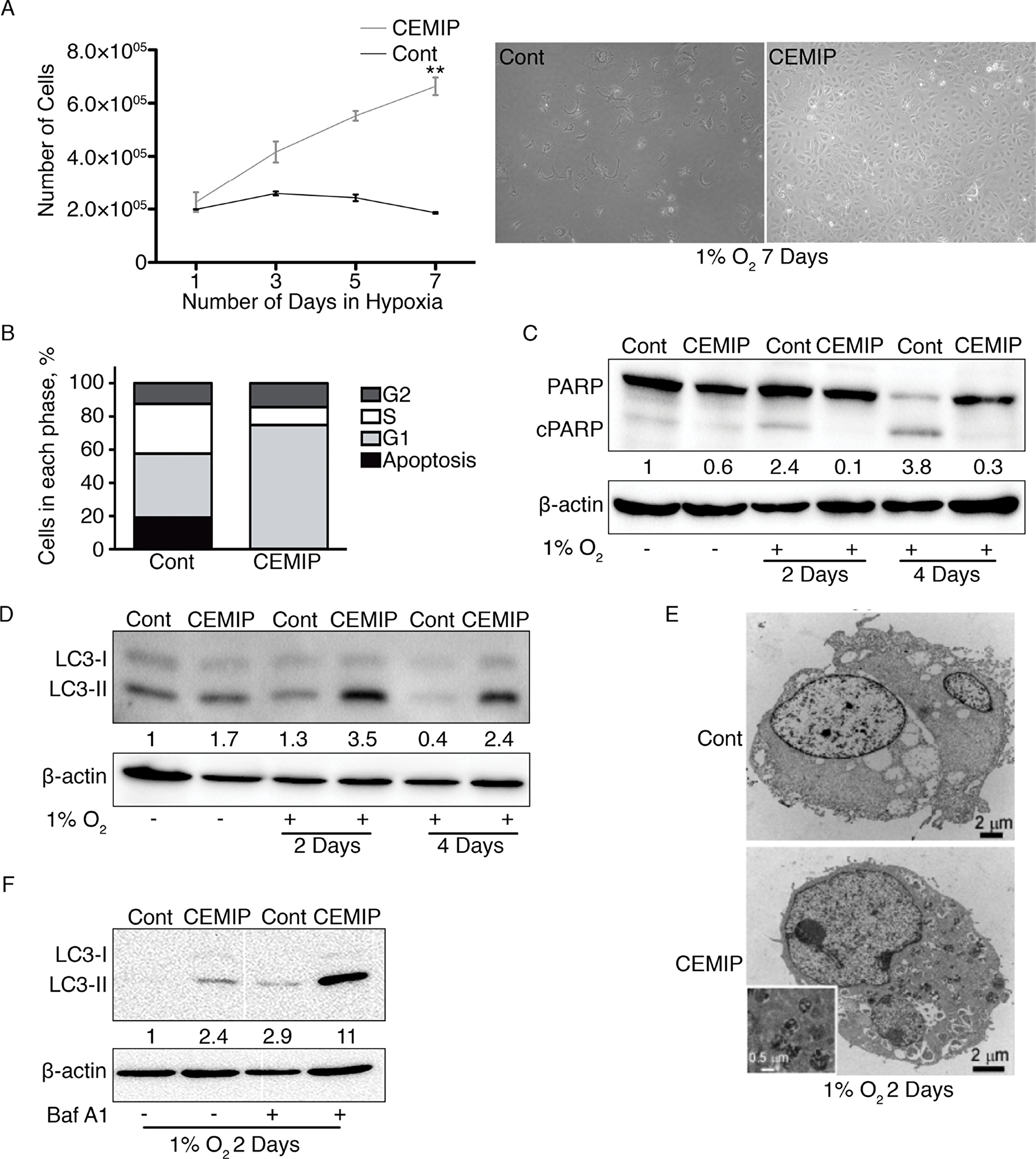 CEMIP promotes cell survival in hypoxic conditions by decreasing apoptosis and increasing autophagy.