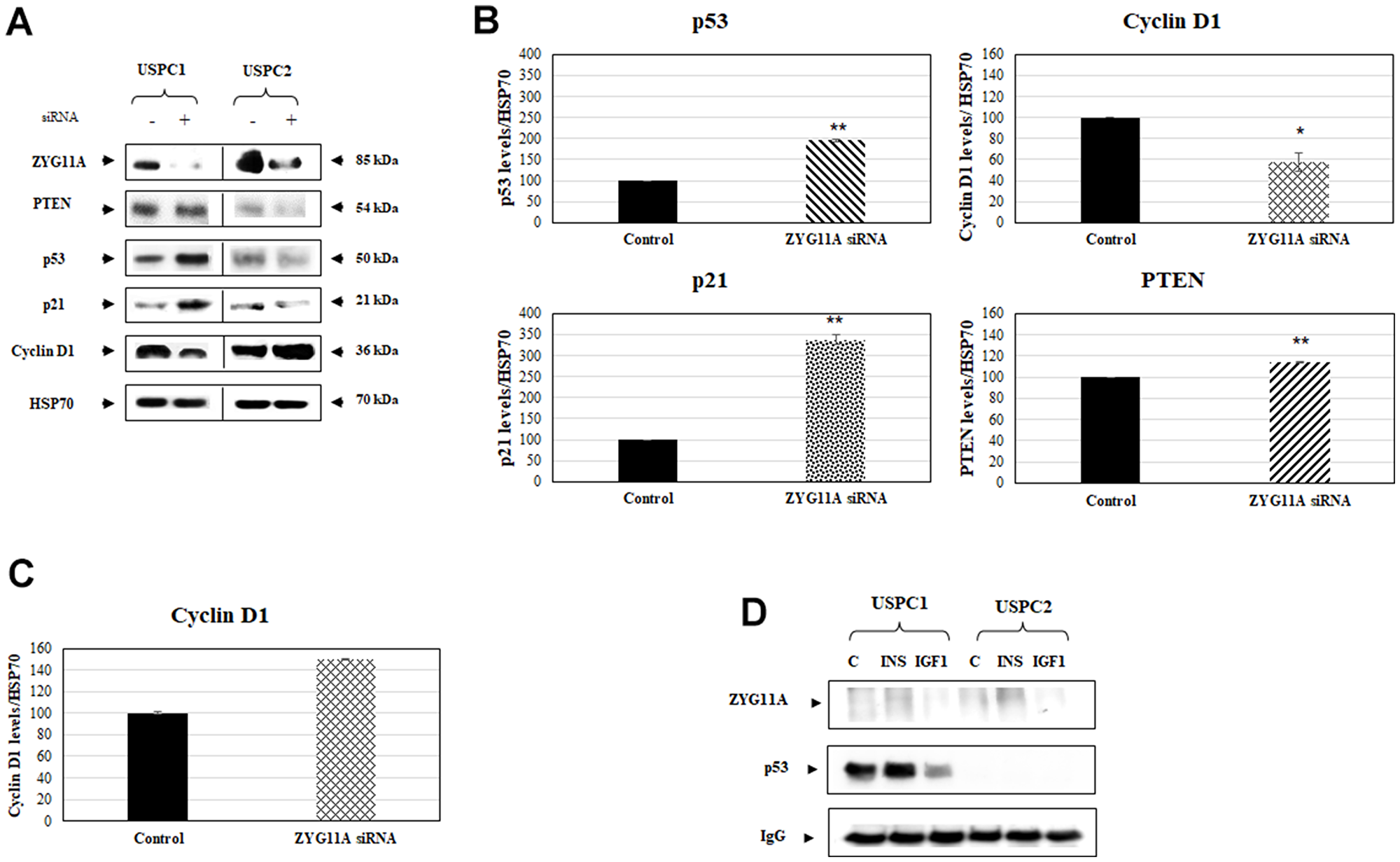 Effect of ZYG11A knockdown on cell cycle regulated proteins.