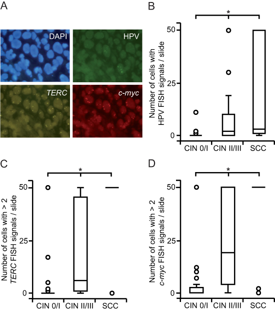 HPV integration, TERC and c-myc copy number gain increase with progressing severity of cervical lesions.