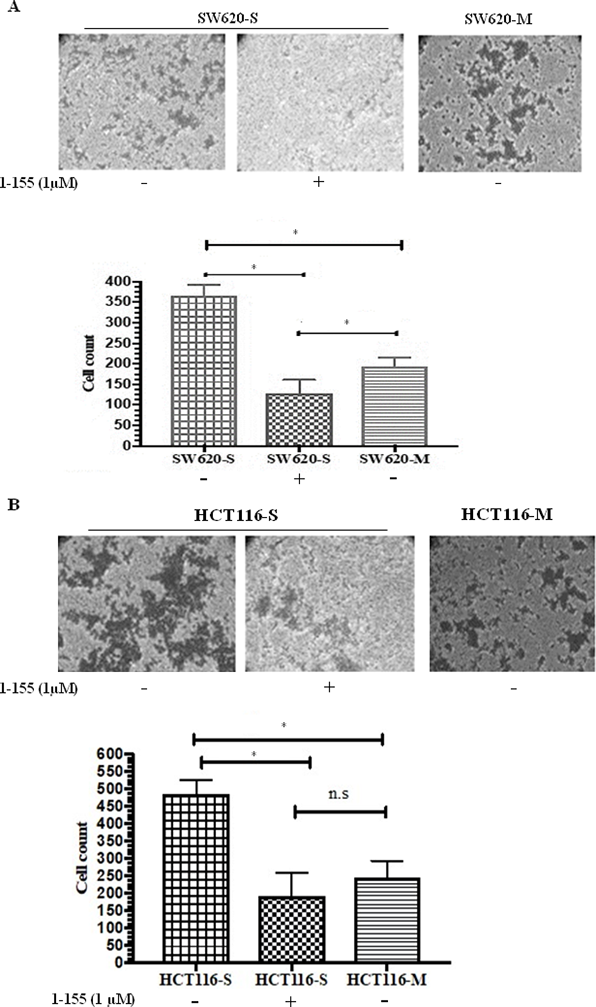TG2 inhibition reduces invasiveness of CRC spheroid cells with stem cell properties.